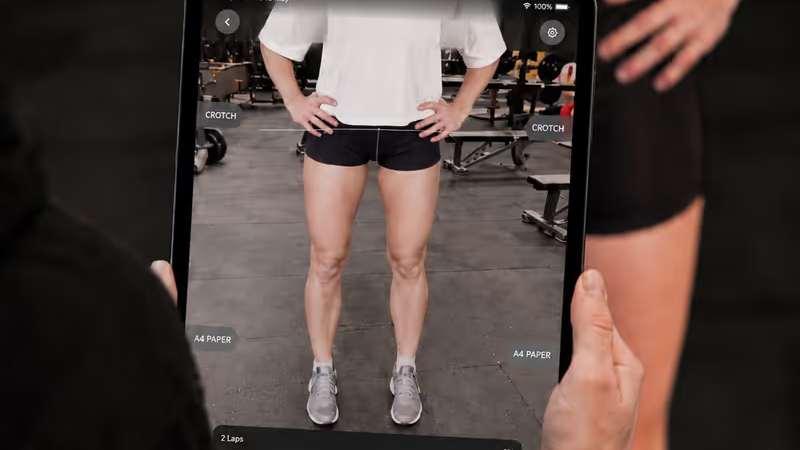 The AutoTailor scanning system (Cape Bionics)